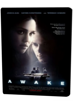  / Awake DUB